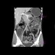 Crohn's disease, chronic ileus due to multiple stenoses, enterography: CT - Computed tomography
